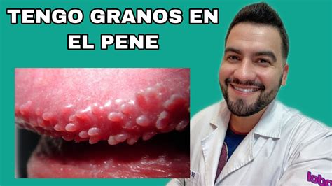 penes con pelo|Enfermedades piel pene